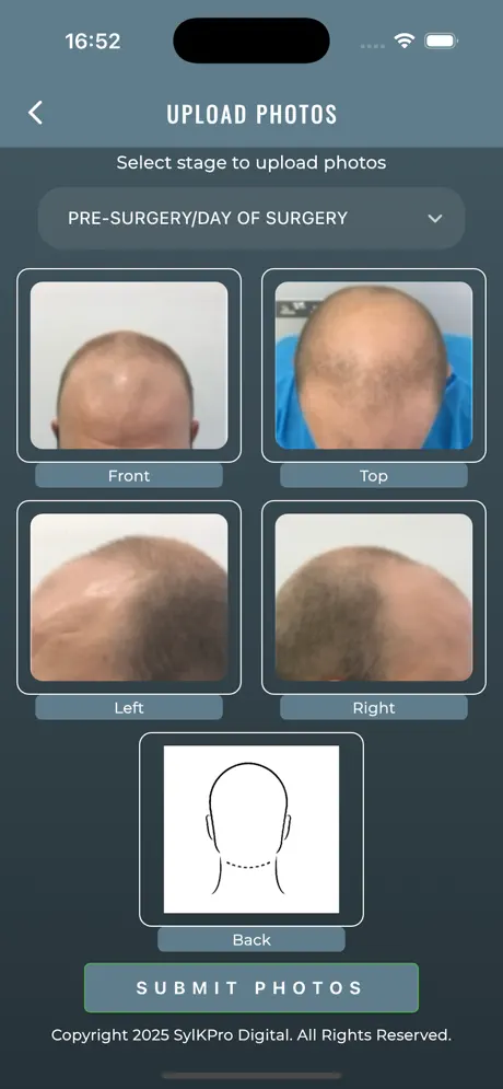 Uploading pre-surgery progress photos