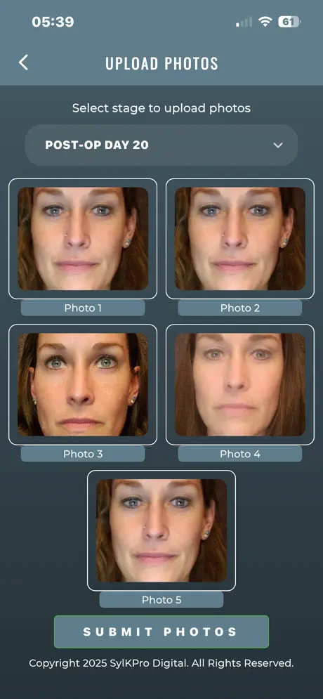 Recovery progress photos at day 30