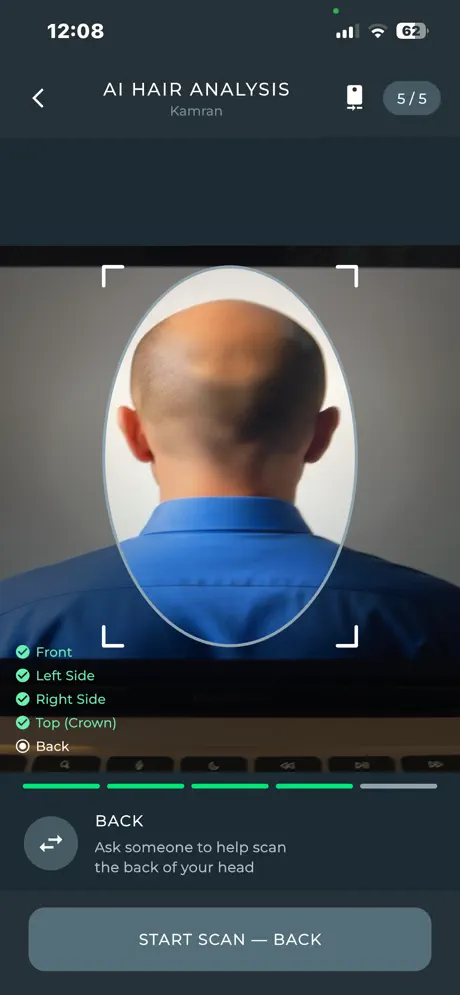 Guided AI hair scan in SurgiTracker Hair & Scalp AI