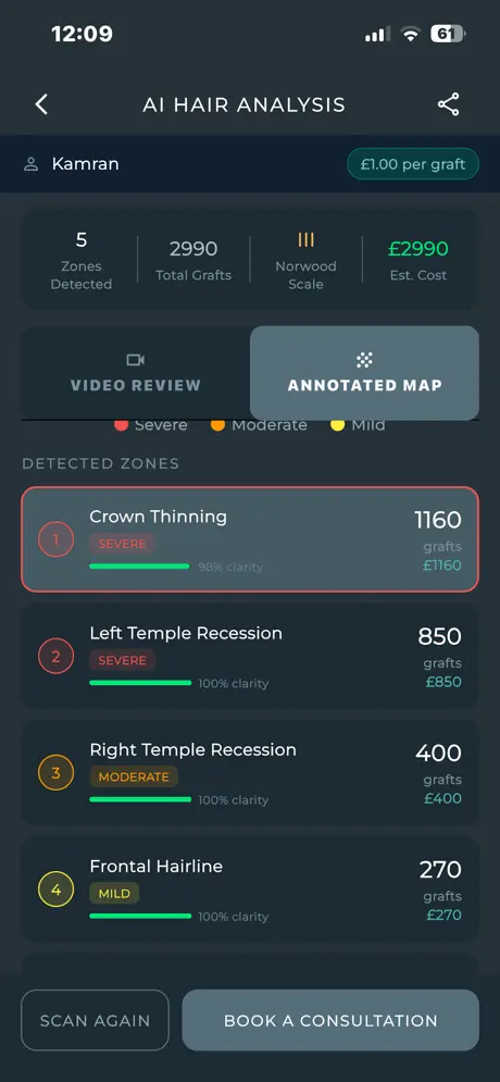 Detected zones with graft counts per zone